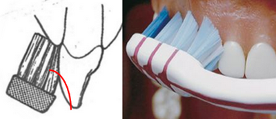 Modifikovana BASS-ova tehnika pranja zuba